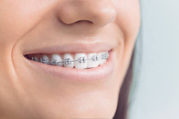 Best Full Mouth Reconstruction  in Madison, MS